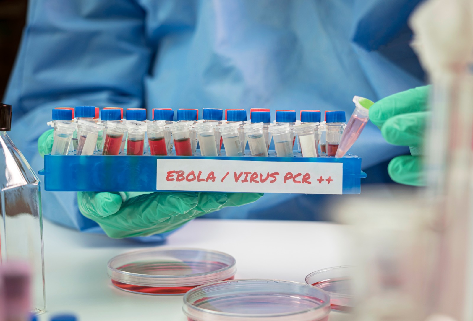 Congo’s Ebola Outbreak Surpasses 10,000 Cases as Regional Transmission Risks Grow